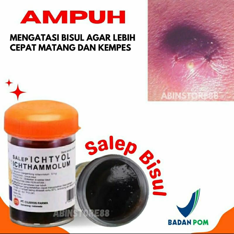 Salep hitam bisul ichtyol