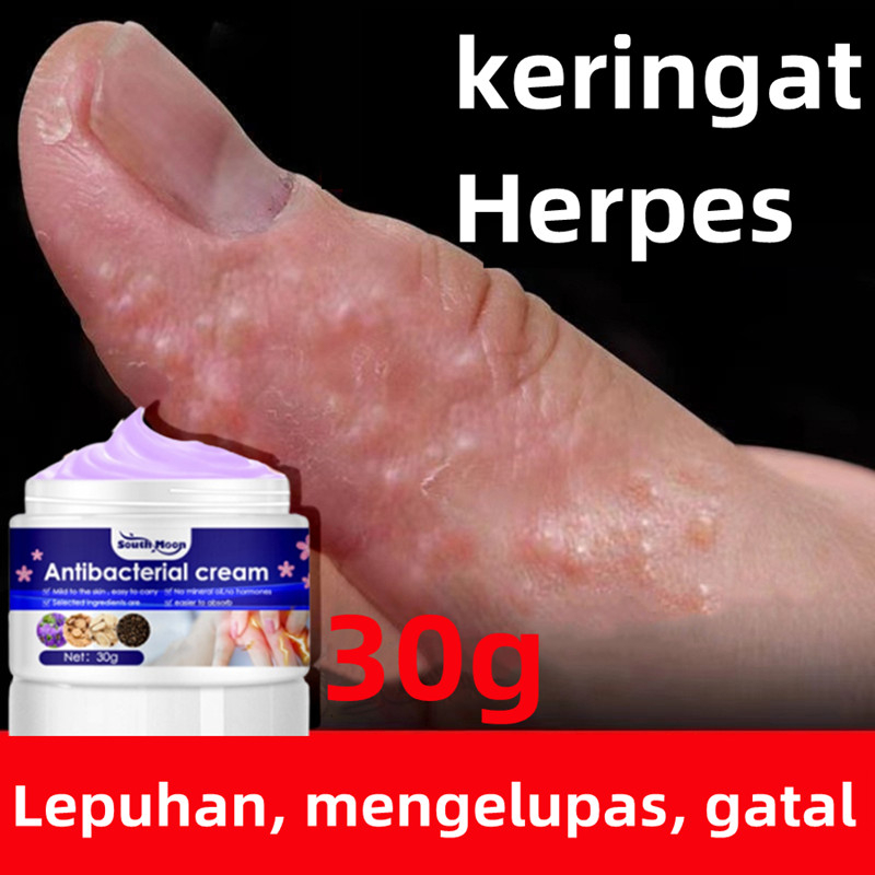 Salep Gatal Paling Ampuh Obat Gatal Kulit Eczema Cream Untuk Orang Yang Tua Dan Anak Untuk Seluruh T