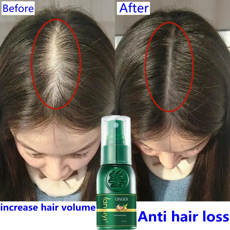 Vitamin rambut rontok Serum rambut rontok Hair tonic rambut rontok Perawatan rambut rontok 30ml Efektif membantu menumbuhkan/menguatkan rambut untuk mencegah kerontokan/membantu rambut menjadi lebih gelap dan cerah