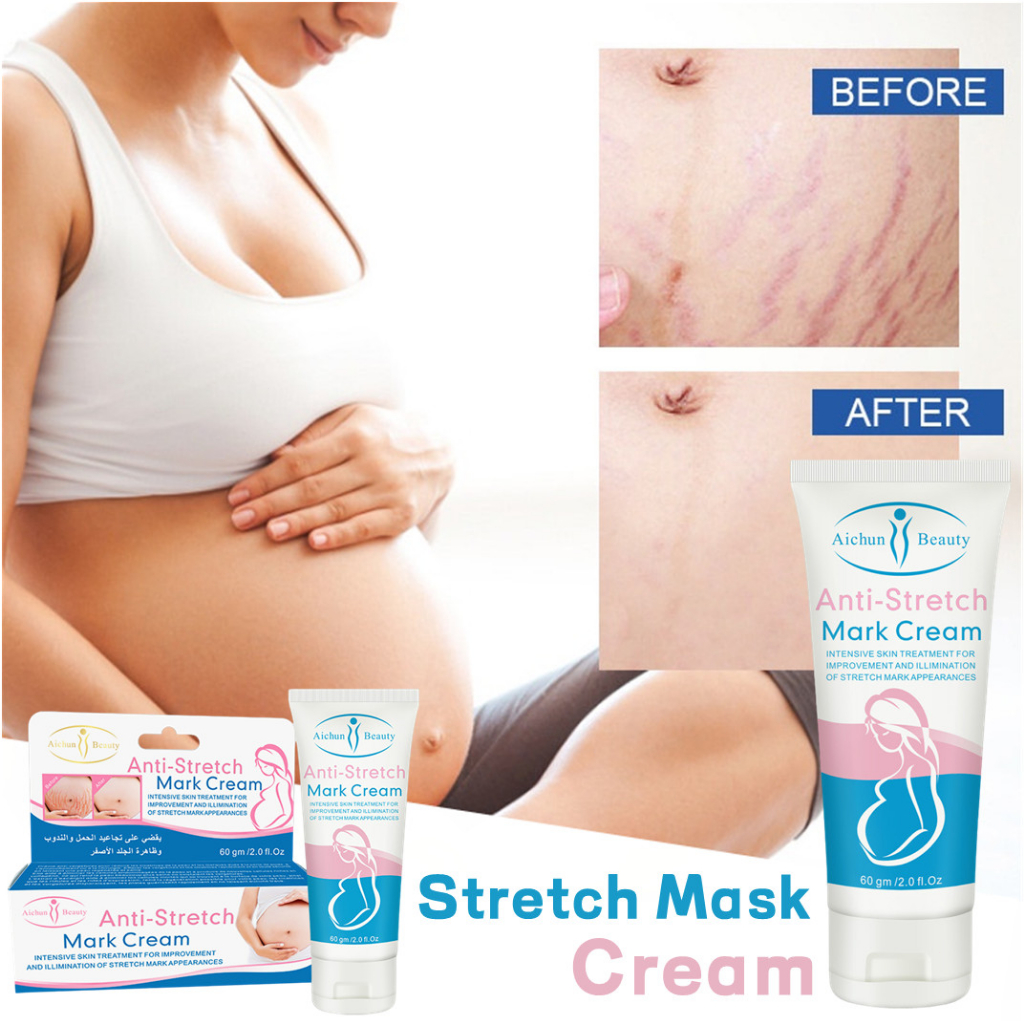 Stretch Mark Cream Anti- Stretch Mark Cream Krim Penghilang Strechmark Pasca Melahirkan Penghilang Bekas Luka 60g [100% Original]