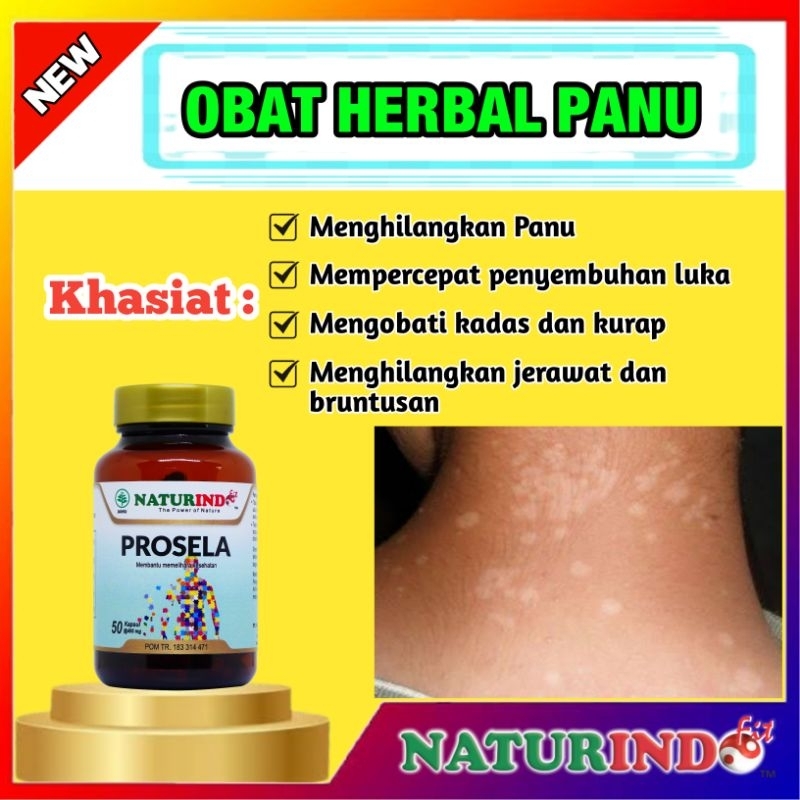 obat panu kronis ampuh - salep kadas dan kurap tablet wajah dan badan kapsul cair Herbal Alami COD