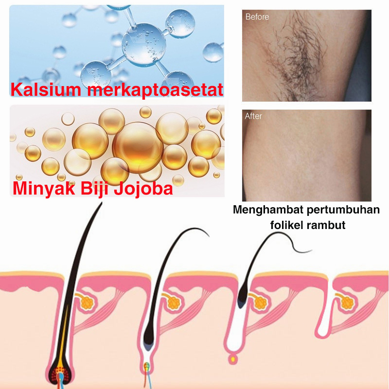 semprotan penghilang bulu kemaluan Hair removal spray semprotan penghilang bulu permanen 50ml/kotak Melembabkan Menghilangkan bulu dengan lembut Menghilangkan bulu tanpa rasa sakit dan cepat