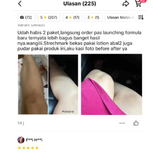 BPOM lotion hb dosting osyin glow racik pemutih badan ampuh penghilang bekas luka bibit pemutih anggur globe