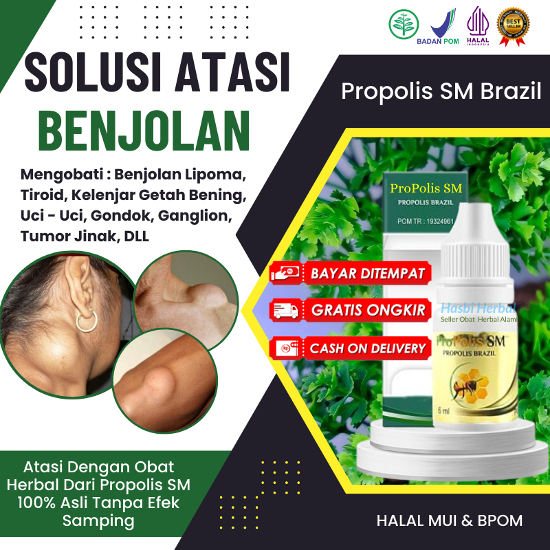 Obat Tradisional Melenyapkan Benjolan Abnormal di Tubuh, Menghilangkan Benjolan Lunak di Punggung Be
