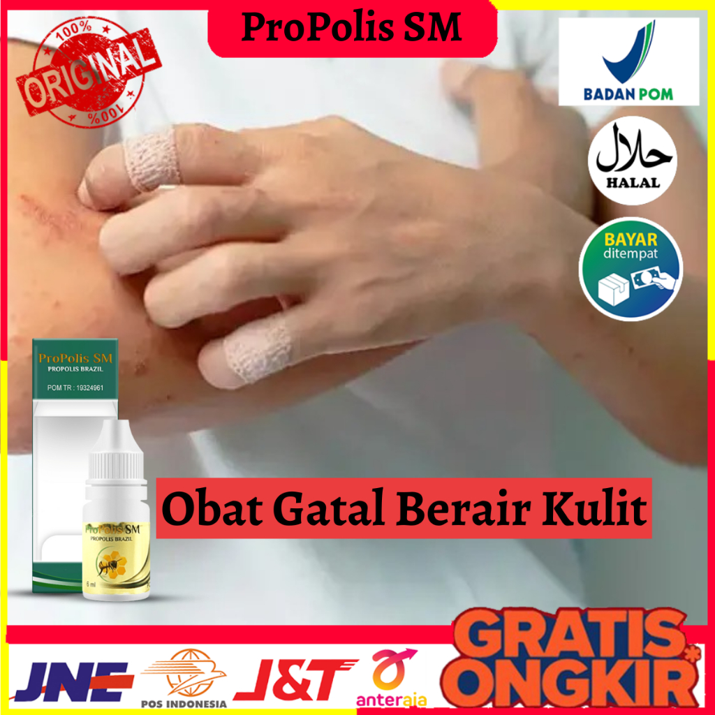 Obat Gatal Berair Kulit, Obat Gatal Kulit, Obat Gatal Berair Di Jari Tangan Dan Kaki, Obat Gatal Bin