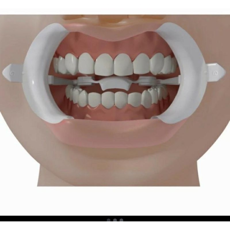 Cheek retractor fleksibel / mouth expander autoclavable untuk dental bleaching gigi