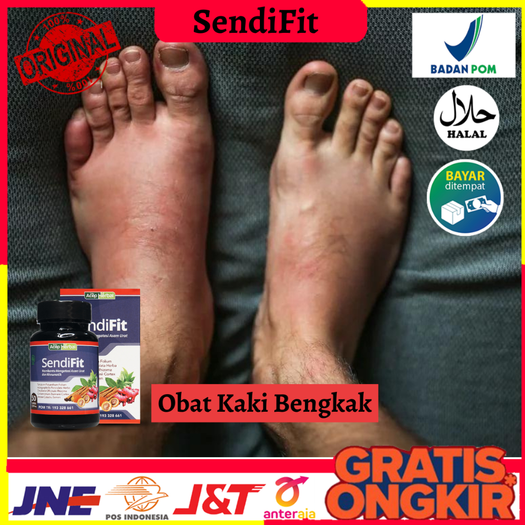 Obat Kaki Bengkak, Obat Nyeri Tumit Kaki, Obat Asam Urat dan Rematik, Obat Nyeri Sendi Lutut Kopong 