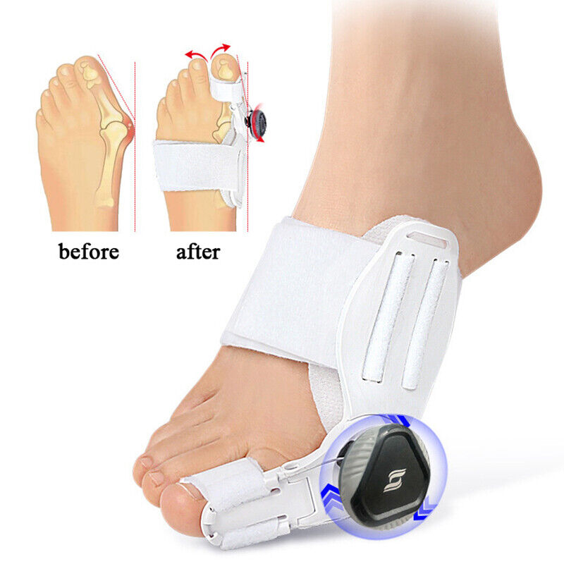 Terapi Bunion Splint Straightener Corrector Adjustable Knob Plus Tali FeetiFix