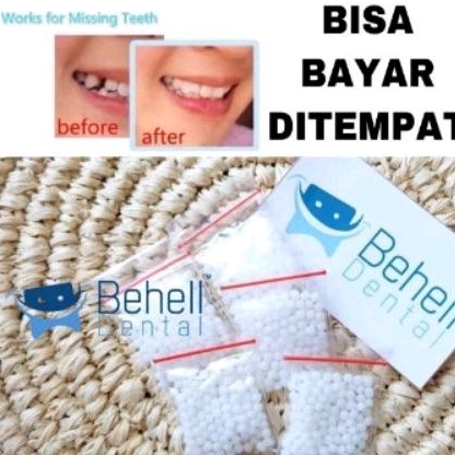 TEMPTOOTH PENAMBAL GIGI ORIGINAL