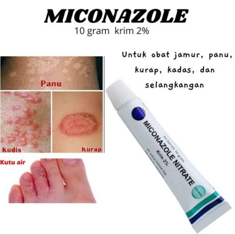 Miconazole cream / salep miconazole exp 2025