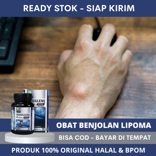 Obat Khusus Benjolan Lipoma, Obat Lipoma, Obat Penghancur Benjolan Lipoma, Obat Pengempes Benjolan L