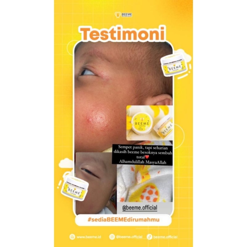 Beeme Nourishing Balm / skincare bayi / krim ruam bayi / beeme free pouch kosmetik