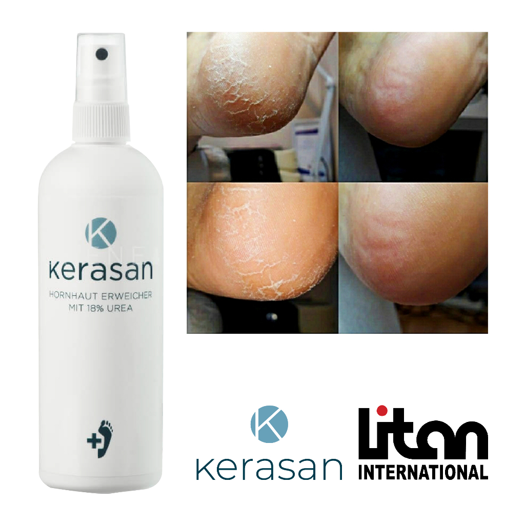 Callus Softener Spray Callusan Non Gehwol Non Footlogix Kapalan Kaki Pecah Pedicure Termurah Berkual