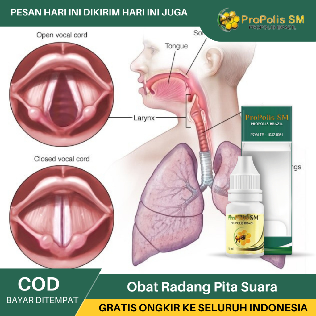 Obat Suara Merdu, Obat Herbal Suara Serak, Obat Untuk Pita Suara, Obat Pita Suara Bengkak, Obat Infe