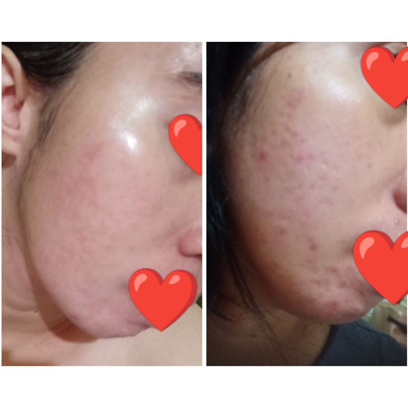 ER Glow Beauty Cream Pemutih Wajah