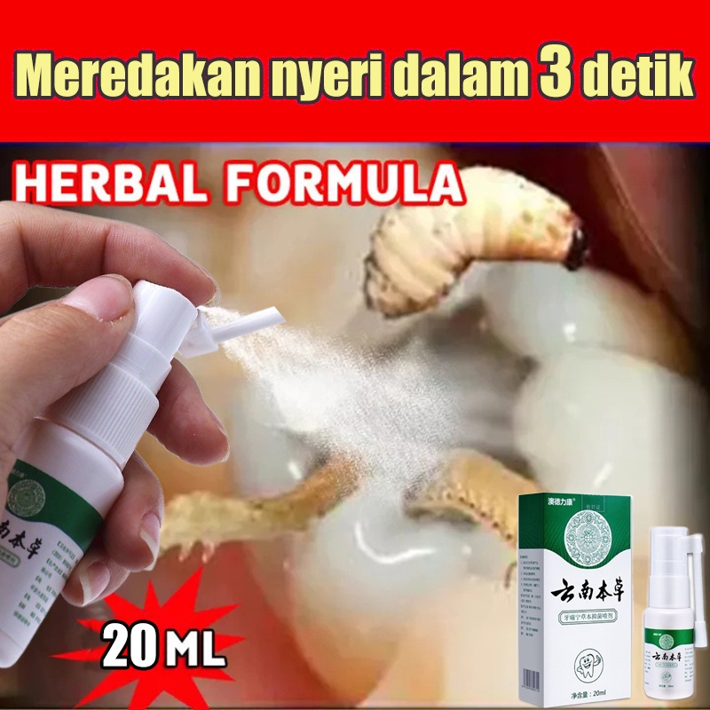 Obat Sakit Gigi Semprotan Pereda Nyeri Gigi Semprotan Antibakteri 20Ml Untuk sakit gigi Perawatan mu