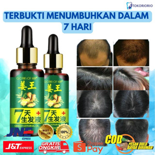 Minyak Penumbuh Rambut Ginger Germinal Oil