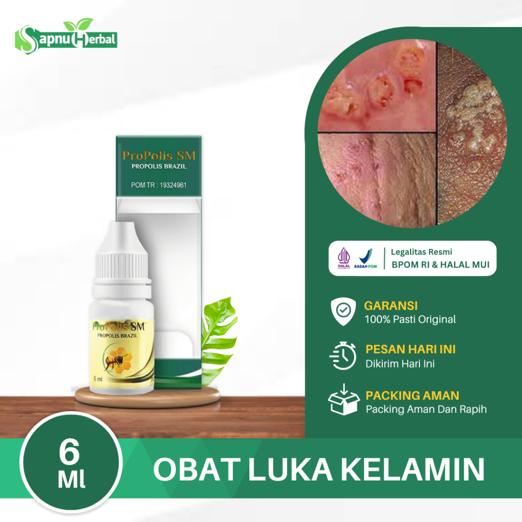 Obat Luka Pada Kelamin Pria, Penis Lecet, Luka Penis, Kulit Penis Perih, Luka Melepuh, Buah Zakar Lu