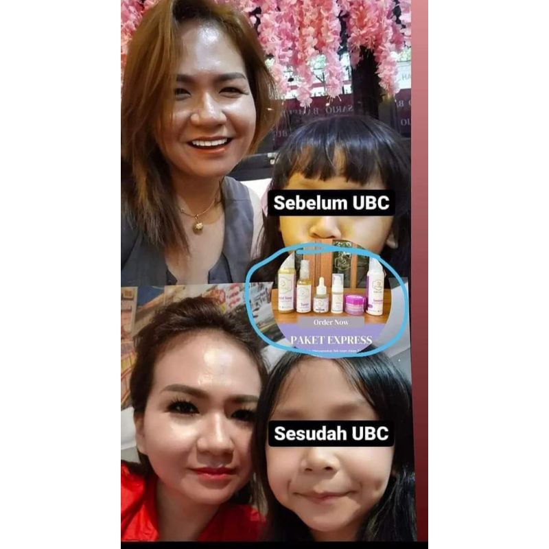 cream UBC (ummi al-Fatih) ORI/asli 100%. cream UBC bpom