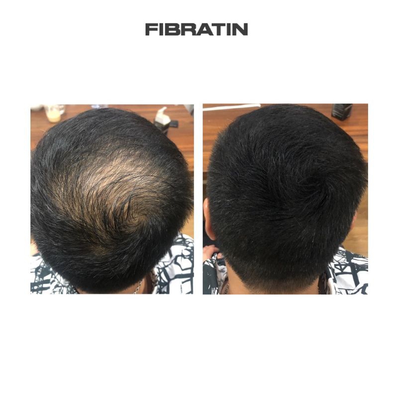 Fibratin Fiber Filler Penebal rambut