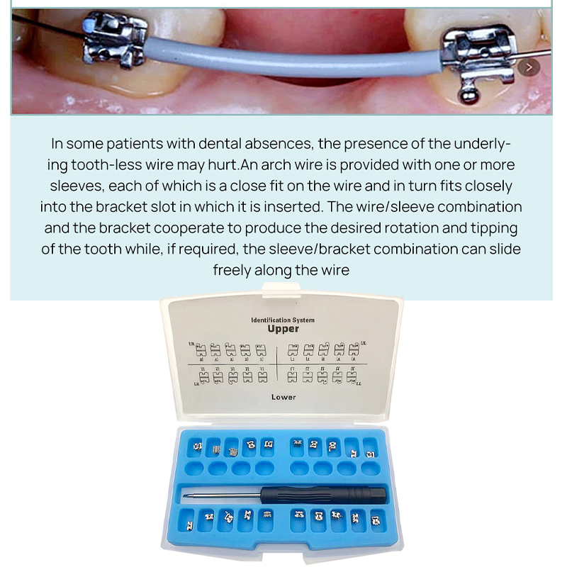 Dental Bracket Self Ligating/Bracket Self Ligating Behel Ortho