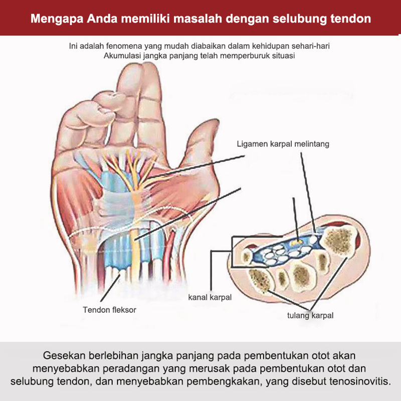 Obat asam urat Obat nyeri sendi Krim pereda nyeri sendi 30g Singkirkan tenosinovitis, asam urat, rematik, nyeri sendi Mengurangi ketidaknyamanan pergelangan tangan Osteoporosis Asam Urat Rematik