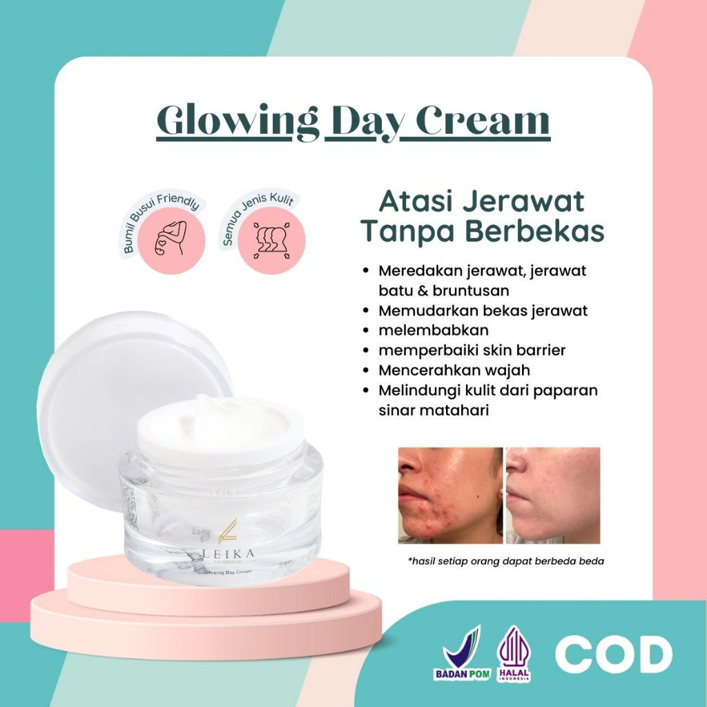 Leika Skincare Glowing Day Cream Penghilang Jerawat Di Wajah Pria Krim Penghilang Jerawat Dan Bekas 