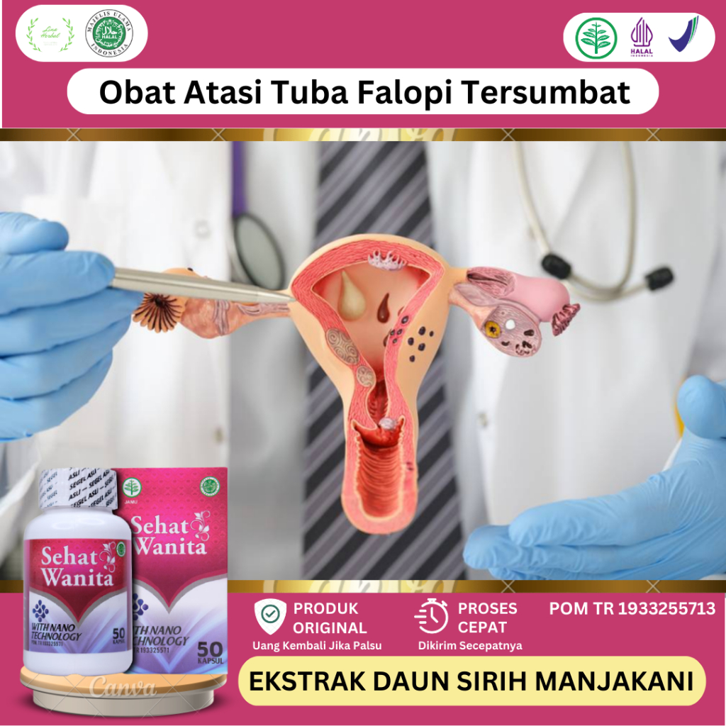 Obat Penyumbatan Tuba Falopi, Obat Untuk Sumbatan Saluran Falopi, Obat Tuba Falopi Tersumbat, Obat P
