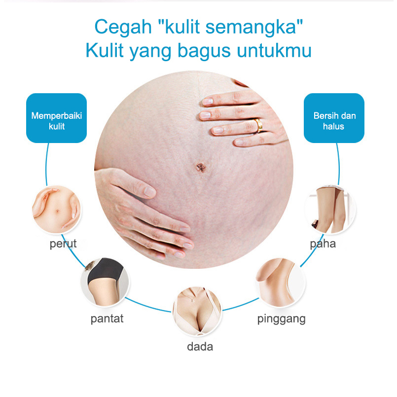 CREAM PENGHILANG STRETCH MARK Krim Stretch Mark 50G Penghilang Bekas Luka Penghilang Keloid Selulit Pregnancy Krim Anti Strechmark Aman untuk Bumil dan Busui