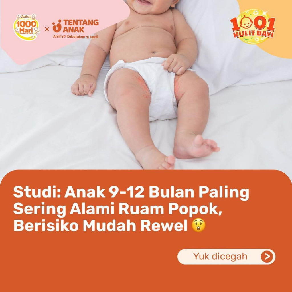 ZWITSAL Extra Care 50 / 100 gr BABY CREAM Daily Diaper Cream switsal melindungi kulit dari iritasi krim ruam popok zinc