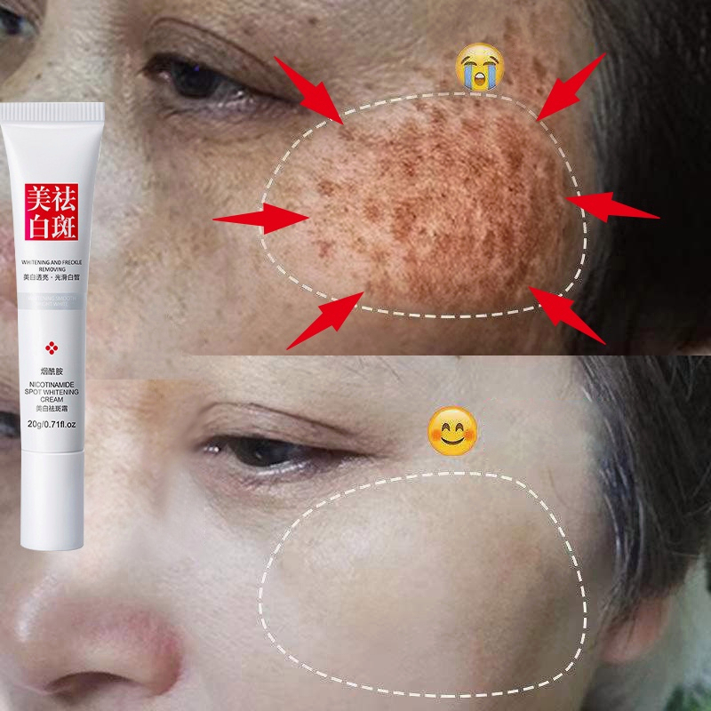 Whitening Freckle Cream Pemutih wajah cream Melasma cream 20g 3% Niacinamide VC 20% + Kolagen Peptid