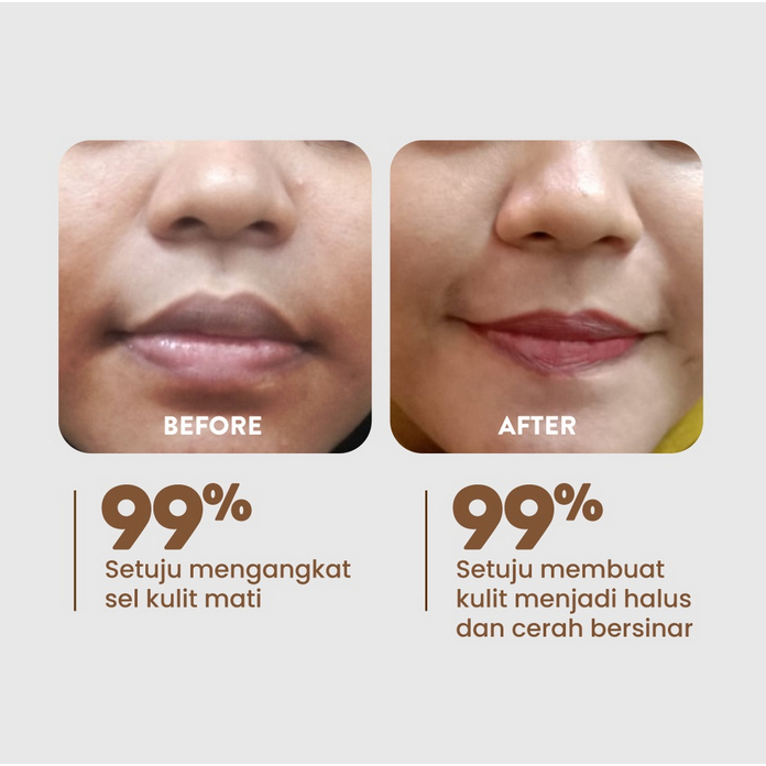 NPURE Brightening Exfoliating Pad Licorice / Light Up / Kapas Wajah Exfoliasi Cerah Glowing mencerahkan garis halus menyamarkan noda hitam anti aging pori pori blackhead jerawat acne prone bekas