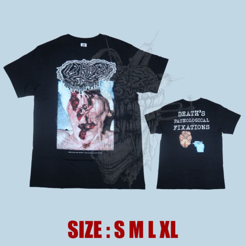 T-shirt - FETAL DEFORMITY - Death Pathological Fixations