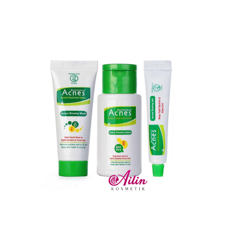 ACNES Starter Pack Creamy Powder Lotion Sealing Jell by Ailin