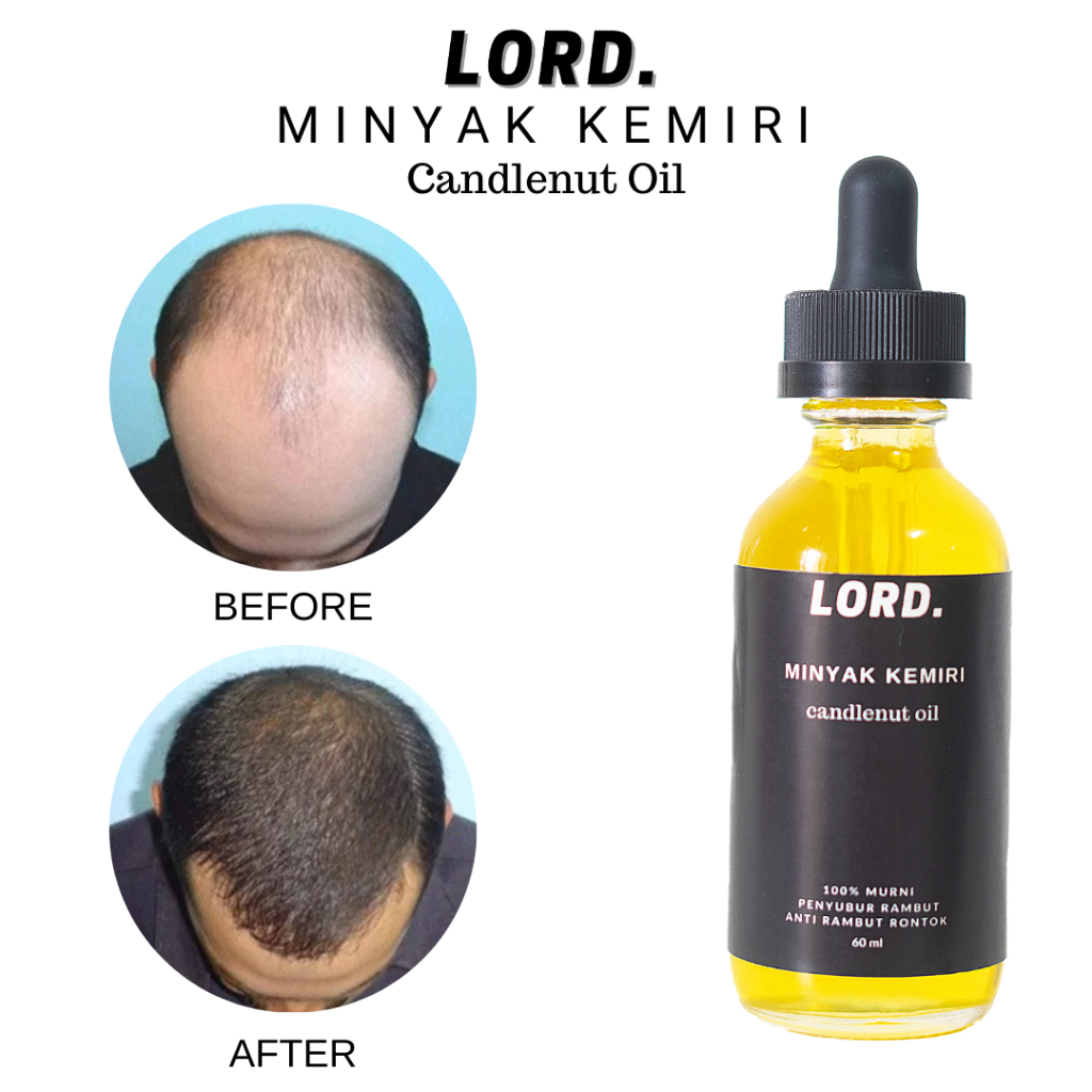Lord  Minyak Kemiri Candlenut Oil Penyubur Rambut 60 ML