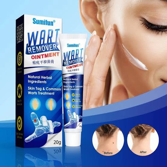 Krim Penghilang Tahi Lalat di Wajah Permanen - Sumifun Wart Remover Original