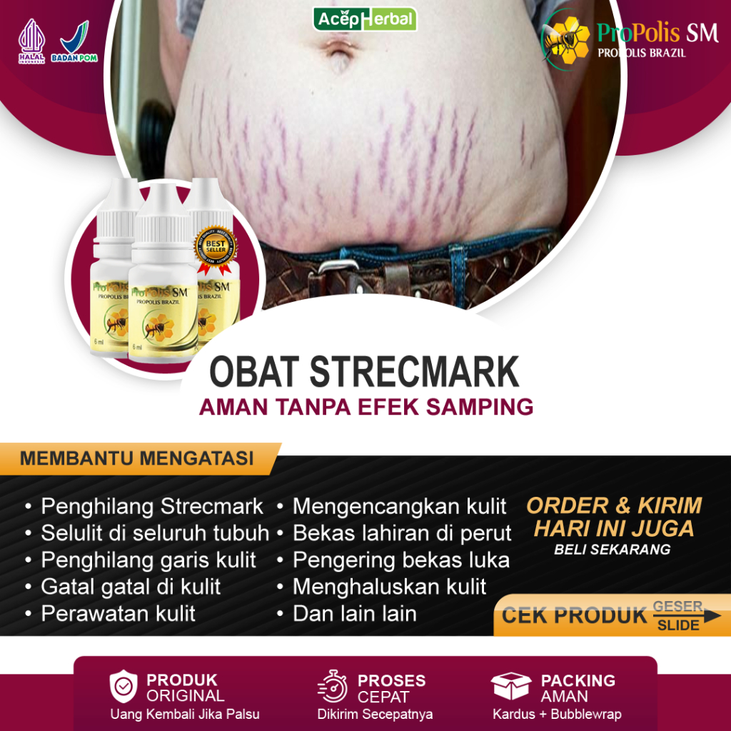 Obat Strecmark Penghilang Bekas Luka Strech Mark Hitam di Perut Paha Betis Bokong Salep Pudarkan Str