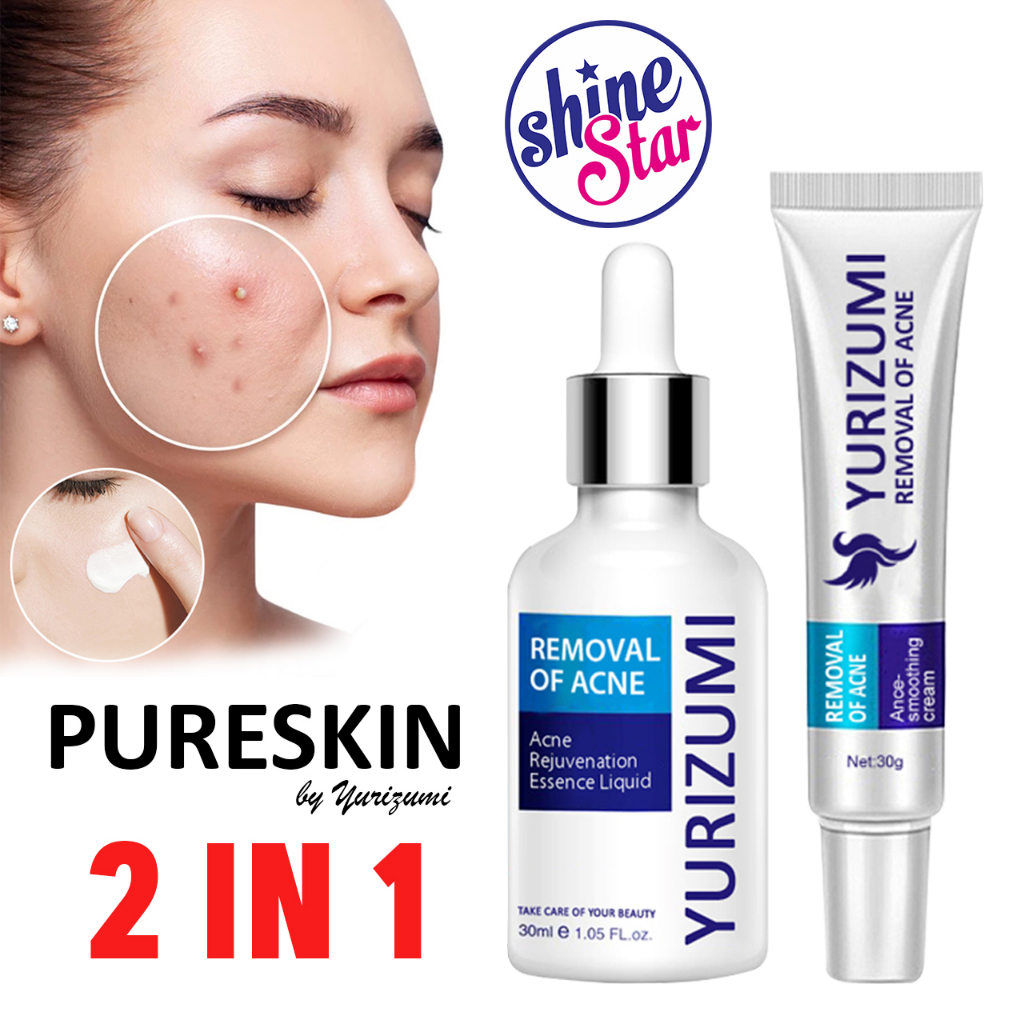 [ 2 In 1 ] Paket Yurizumi Acne Pure Skin Cream + Serum Obat Jerawat Paling Ampuh Menghilangkan Jerawat dan Bekas Jerawat