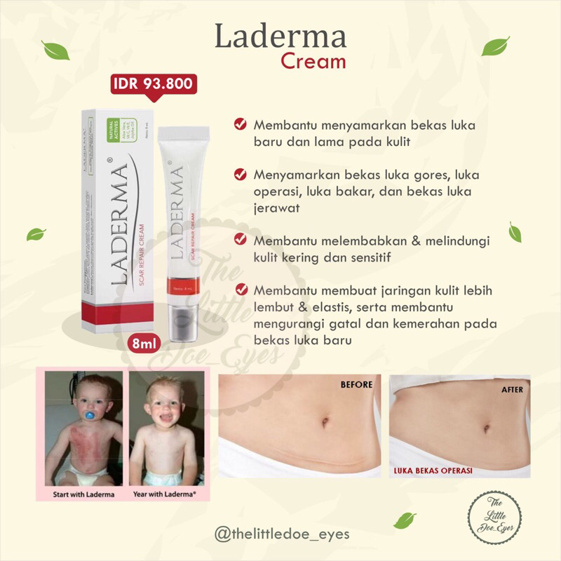 Laderma Cream Pemudar Bekas Luka - 8ml EXP 08/2024