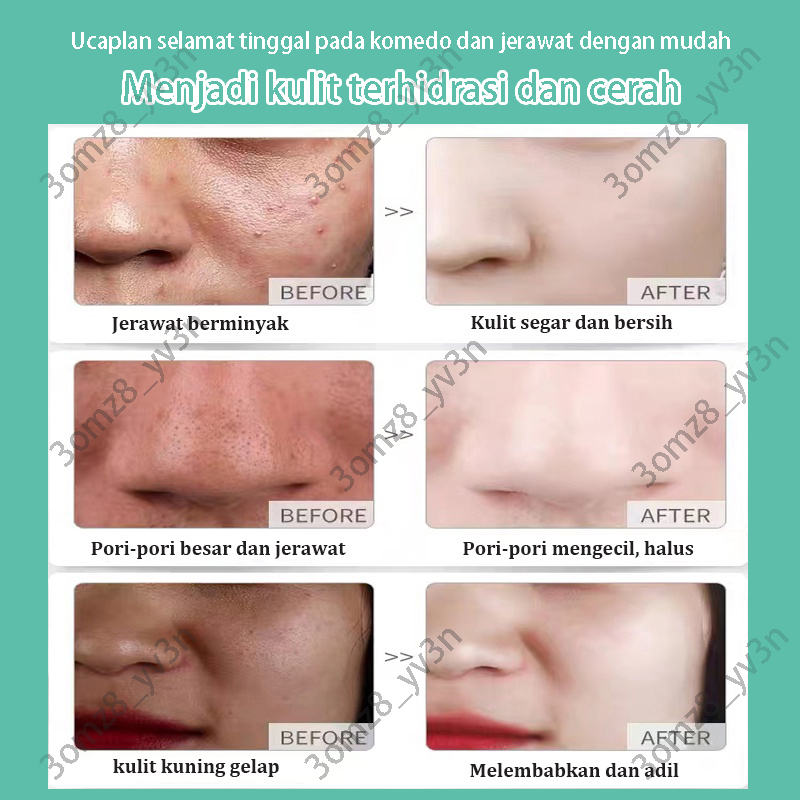 Pembersih Wajah pembersih jerawat sabun pembersih wajah 500ml Jerawat Pembersih Susu Kontrol Minyak Pemutih Wajah Pelembab Moisturizing