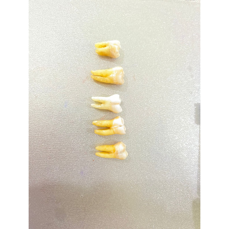 gigi molar bawah