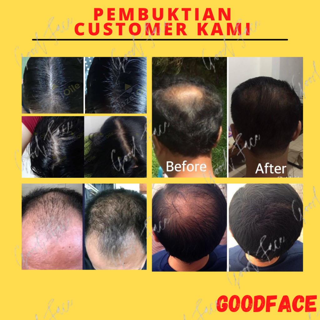 MINYAK KEMIRI ASLI PENUMBUH RAMBUT PENUMBUH ALIS PENYUBUR RAMBUT KEBOTAKAN BMKS MINYAK KEMIRI