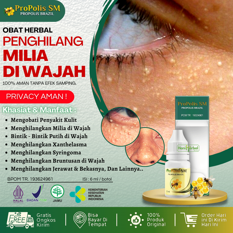 OBAT PENGHILANG MILIA / SALEP MILIA / OBAT OLES MILIA / OBAT BUAT MILIA / JERAWAT MILIA - HERBAL PRO