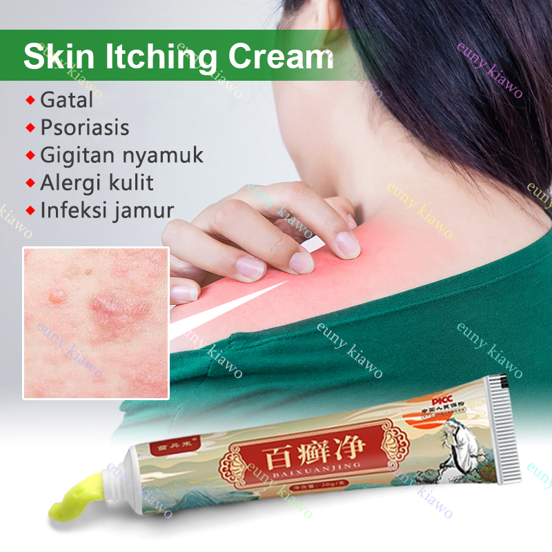 Obat Gatal Salep gatal Salep eksim Obat psoriasis Salep psoriasis 20G 【100% Original】Salep Kulit Jamur Dermatitis Psoriasis Eksim Jamur Kurap Alergi Kulit Cream Obat Gatal