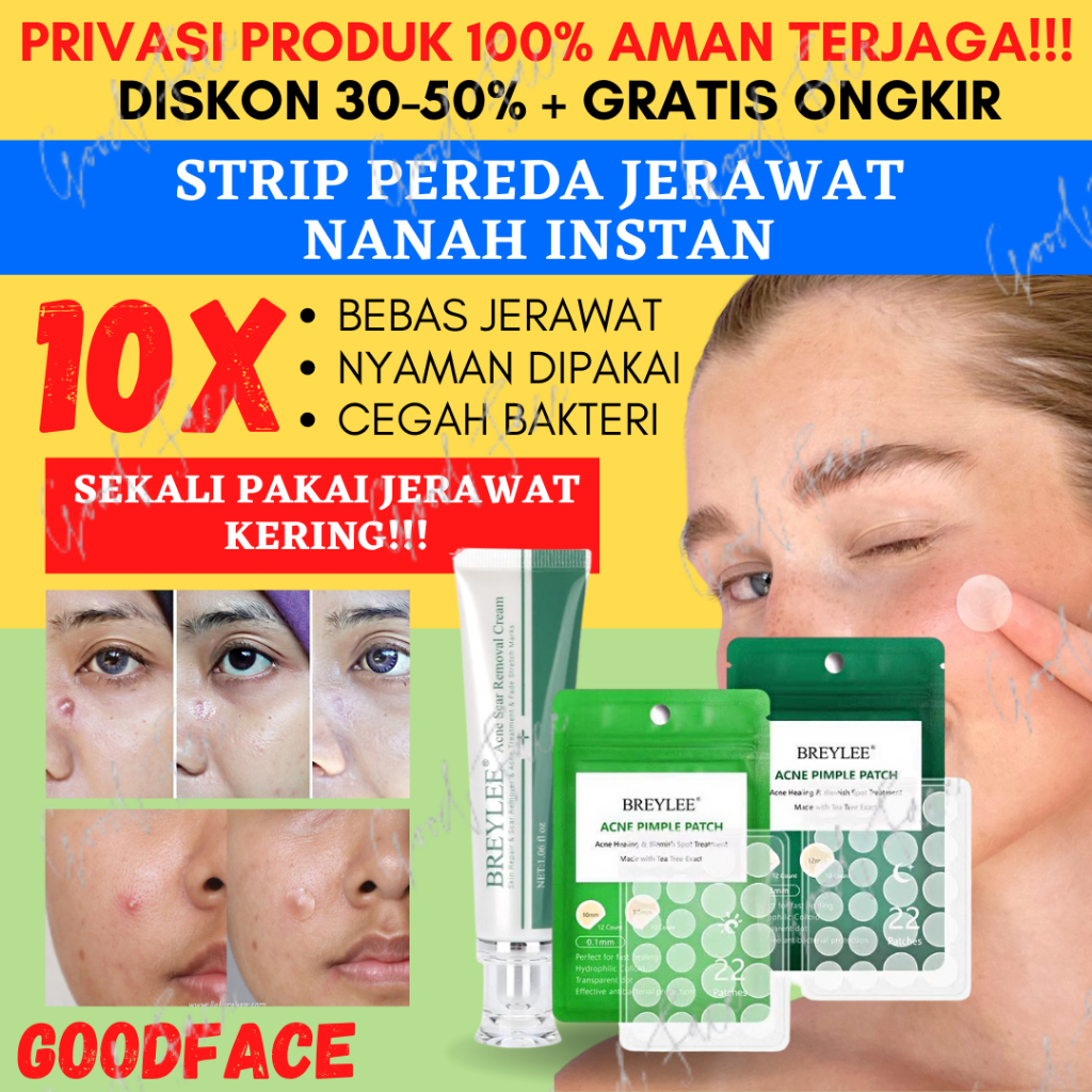 PENGHILANG JERAWAT BREYLEE Acne Simple Treatment A Perawatan Wajah Berjerawat 3 pcs