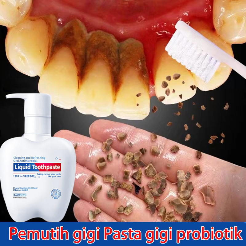 Pemutih Gigi - Pemutih Gigi Dan Penghilang Karang Gigi -200g Pasta Gigi Pemutih Probiotik Memutihkan Kuning Gigi Dan Membersihkan Karang Gigi Paling Ampuh Odol Pemutih Gigi Menghilangkan Bau Mulut Pasta Gigi