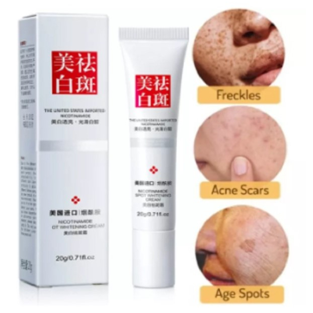 Youbuy Whitening Freckle Cream Remove Dark Spots Anti Freckle Cream Pemutih Waja Melasma Flek Hitam