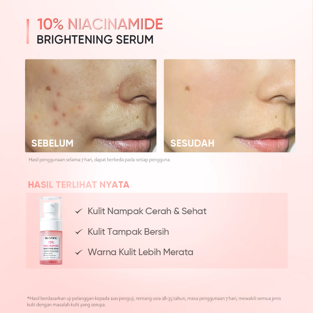 SKINTIFIC 10% niacinamide Brightening serum 20ML &amp; 7 days fades dark spot Skintific Serum Whitening