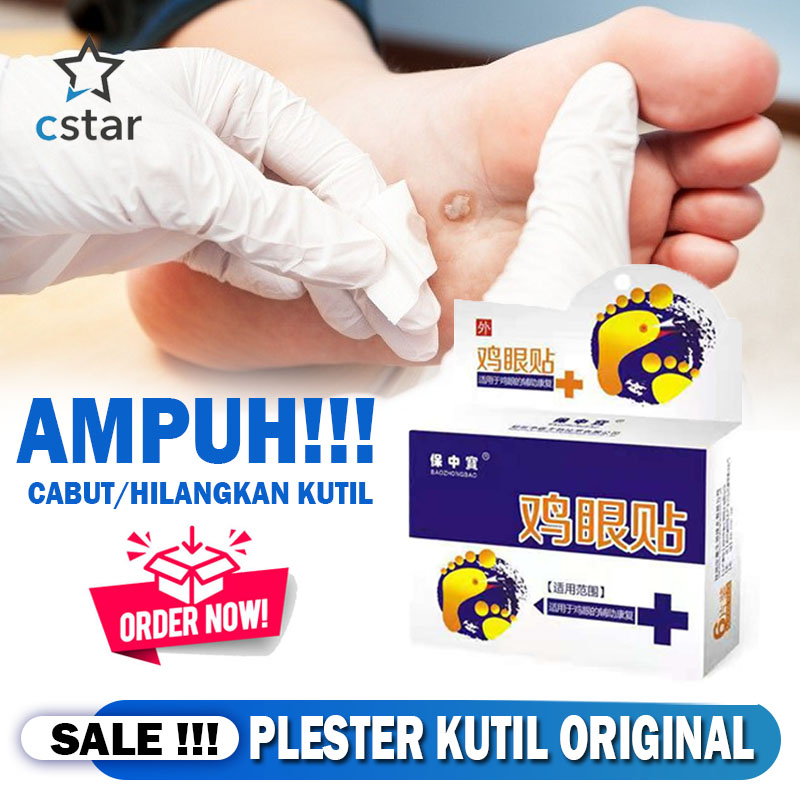 [ORI] Ji Yen Tie Plester Obat Kutil Mata Ikan Kapalan - 1 Box Isi 6 Pcs