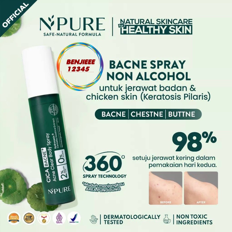 npure BACNE spray jerawat punggung badan N’pure bacne chicken skin NPURE N pure BACNE ACNE body